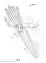 Fig. 10 - Apparatus and methods for bone repair preparation