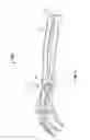 Fig. 11 - Apparatus and methods for bone repair preparation