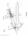 Fig. 14 - Apparatus and methods for bone repair preparation