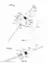 Fig. 18 - Apparatus and methods for bone repair preparation