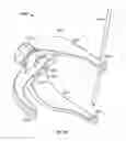 Fig. 28 - Apparatus and methods for bone repair preparation