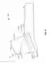Fig. 31 - Apparatus and methods for bone repair preparation