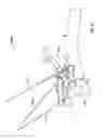 Fig. 35 - Apparatus and methods for bone repair preparation