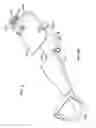 Fig. 47 - Apparatus and methods for bone repair preparation