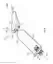 Fig. 48 - Apparatus and methods for bone repair preparation