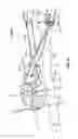 Fig. 52 - Apparatus and methods for bone repair preparation