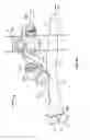 Fig. 53 - Apparatus and methods for bone repair preparation