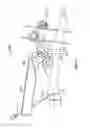 Fig. 54 - Apparatus and methods for bone repair preparation