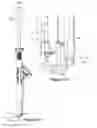 Fig. 16 - Tether clamp and implantation system