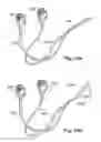Fig. 24 - Tether clamp and implantation system
