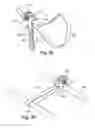 Fig. 25 - Tether clamp and implantation system