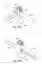 Fig. 26 - Tether clamp and implantation system