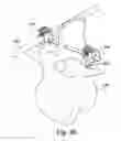 Fig. 27 - Tether clamp and implantation system