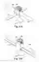 Fig. 30 - Tether clamp and implantation system