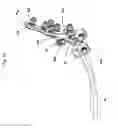 Fig. 03 - Adjustable fixation device