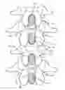 Fig. 01 - METHODS AND SYSTEMS FOR LATERALLY STABILIZED CONSTRAINT OF SPINOUS PROCESSES