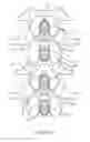 Fig. 07 - METHODS AND SYSTEMS FOR LATERALLY STABILIZED CONSTRAINT OF SPINOUS PROCESSES