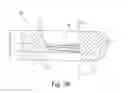 Fig. 19 - Methods for implanting bone plates