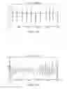 Fig. 09 - Ventricular far field reduction