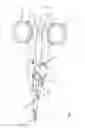 Fig. 10 - Bipolar electrosurgical sealer and divider