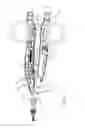 Fig. 13 - Bipolar electrosurgical sealer and divider