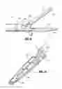 Fig. 07 - Vessel sealer and divider for use with small trocars and cannulas