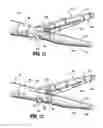 Fig. 08 - Vessel sealer and divider for use with small trocars and cannulas