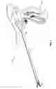 Fig. 02 - Method of constructing a jaw member for an end effector assembly