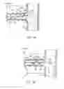 Fig. 04 - SYSTEM AND METHOD FOR DENERVATION