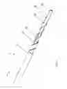 Fig. 02 - Selective stiffening catheter and methods for operating a selective stiffening catheter