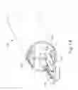 Fig. 20 - Electrosurgical instrument with removable jaw components