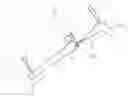 Fig. 01 - Digital tool and method for planning knee replacement