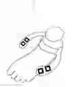 Fig. 02 - Digital tool and method for planning knee replacement