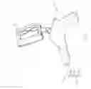Fig. 06 - Digital tool and method for planning knee replacement