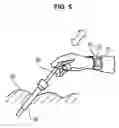 Fig. 05 - ASSISTANCE DEVICE FOR IMAGING SUPPORT OF A SURGEON DURING A SURGICAL OPERATION