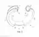 Fig. 02 - Combination lip retractor and guard with integrated light source, suction, and surgical smoke plume filter