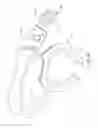 Fig. 07 - Combination lip retractor and guard with integrated light source, suction, and surgical smoke plume filter