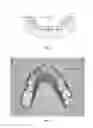 Fig. 04 - DIRECT FRACTIONAL STEP METHOD FOR GENERATING TOOTH ARRANGEMENT