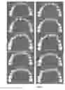 Fig. 07 - DIRECT FRACTIONAL STEP METHOD FOR GENERATING TOOTH ARRANGEMENT
