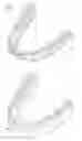 Fig. 01 - Tracking teeth movement correction