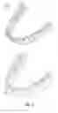 Fig. 02 - Tracking teeth movement correction