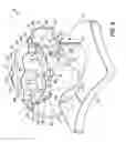 Fig. 09 - SELF-LIGATING ORTHODONTIC BRACKET WITH ROTATABLE CLOSURE MEMBER