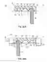 Fig. 24 - SELF-LIGATING ORTHODONTIC BRACKET WITH ROTATABLE CLOSURE MEMBER