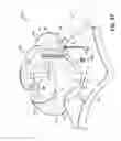 Fig. 37 - SELF-LIGATING ORTHODONTIC BRACKET WITH ROTATABLE CLOSURE MEMBER