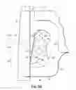 Fig. 07 - Biased pivoting slide orthodontic bracket
