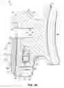 Fig. 10 - Biased pivoting slide orthodontic bracket