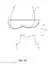 Fig. 15 - System and method for fabricating a dental restoration