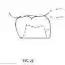 Fig. 22 - System and method for fabricating a dental restoration