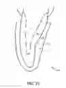 Fig. 32 - System and method for fabricating a dental restoration