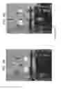 Fig. 07 - Insufflation apparatus and methods